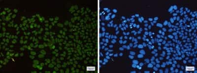 Immunocytochemistry/ Immunofluorescence: Histone Deacetylase 2/HDAC2 Antibody (S06-4E4) [NBP3-14893]