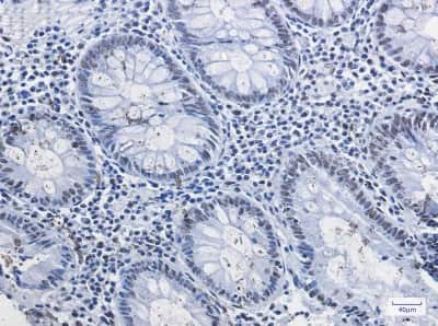 Immunohistochemistry-Paraffin: Histone Deacetylase 2/HDAC2 Antibody (S06-4E4) [NBP3-14893]