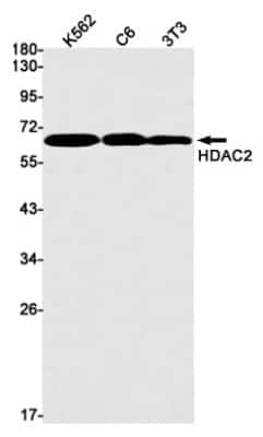 Western Blot: Histone Deacetylase 2/HDAC2 Antibody (S06-4E4) [NBP3-14893]