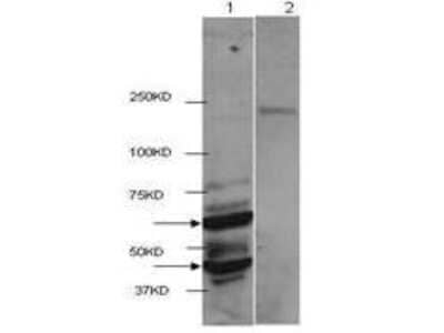 Western Blot: Histone Deacetylase 2/HDAC2 Antibody [NBP1-44095]