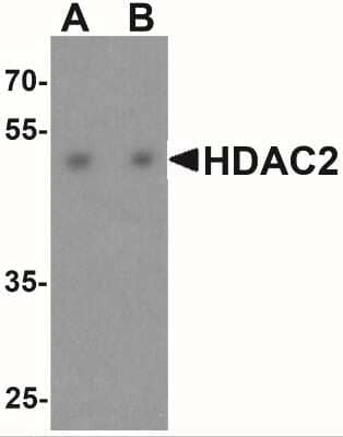 Western Blot: Histone Deacetylase 2/HDAC2 AntibodyBSA Free [NBP2-41285]