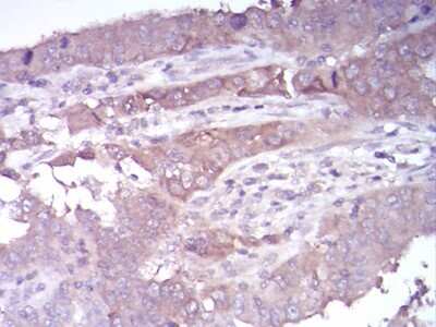 Immunohistochemistry: Histone Deacetylase 4/HDAC4 Antibody (5E4A5) - BSA Free [NBP2-52480]
