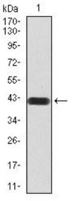 Western Blot: Histone Deacetylase 4/HDAC4 Antibody (5E4A5)BSA Free [NBP2-52480]