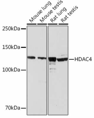 Western Blot: Histone Deacetylase 4/HDAC4 Antibody (9A6E2) [NBP3-15463]