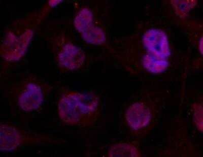 Immunocytochemistry/ Immunofluorescence: Histone Deacetylase 4/HDAC4 Antibody [NBP2-03981]