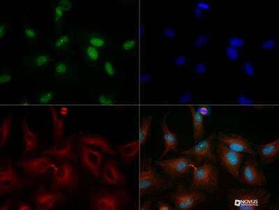 Immunocytochemistry/ Immunofluorescence: Histone Deacetylase 4/HDAC4 Antibody - BSA Free [NBP2-22151]