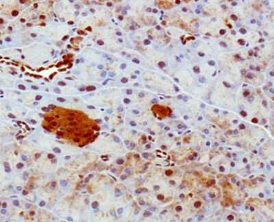 Immunohistochemistry: Histone Deacetylase 4/HDAC4 Antibody - BSA Free [NBP2-22151]