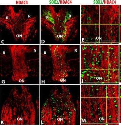 Immunohistochemistry: Histone Deacetylase 4/HDAC4 Antibody - BSA Free [NBP2-22151]