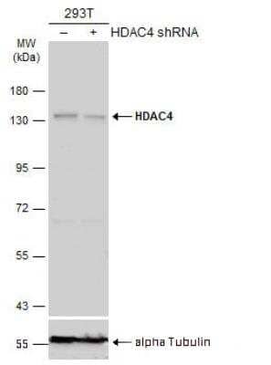 Knockdown Validated: Histone Deacetylase 4/HDAC4 Antibody [NBP2-16793]