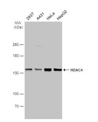 Western Blot: Histone Deacetylase 4/HDAC4 Antibody [NBP2-16793]