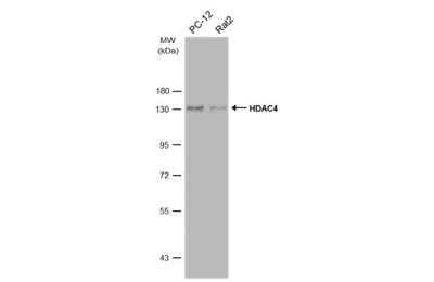 Western Blot: Histone Deacetylase 4/HDAC4 Antibody [NBP2-16793]