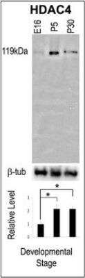 Western Blot: Histone Deacetylase 4/HDAC4 AntibodyBSA Free [NBP2-22151]