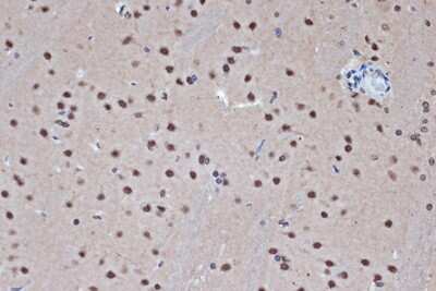 Immunohistochemistry-Paraffin: Histone Deacetylase 8/HDAC8 Antibody (1O2Y5) [NBP3-16713]
