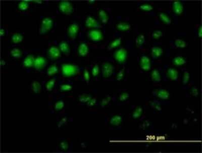 Immunocytochemistry/ Immunofluorescence: Histone Deacetylase 8/HDAC8 Antibody (2F4) [H00055869-M01]