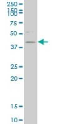 Western Blot: Histone Deacetylase 8/HDAC8 Antibody (2F4) [H00055869-M01]