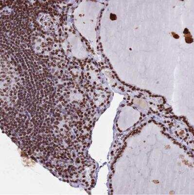 Immunohistochemistry-Paraffin: Histone Deacetylase 8/HDAC8 Antibody [NBP2-14085]