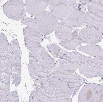 Immunohistochemistry-Paraffin: Histone Deacetylase 8/HDAC8 Antibody [NBP2-14085]