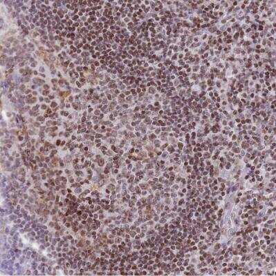 Immunohistochemistry-Paraffin: Histone Deacetylase 8/HDAC8 Antibody [NBP2-14085]