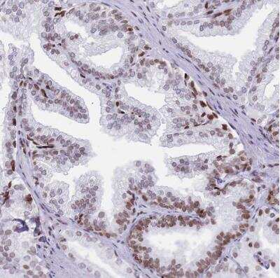 Immunohistochemistry-Paraffin: Histone Deacetylase 8/HDAC8 Antibody [NBP2-14085]