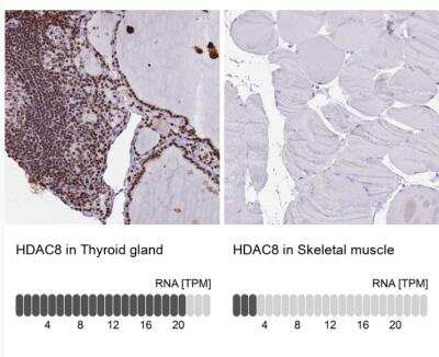 Immunohistochemistry-Paraffin: Histone Deacetylase 8/HDAC8 Antibody [NBP2-14085]