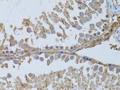 Immunohistochemistry-Paraffin: Histone Deacetylase 8/HDAC8 Antibody - BSA Free [NBP3-03473]