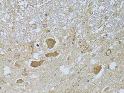 Immunohistochemistry-Paraffin: Histone Deacetylase 8/HDAC8 Antibody - BSA Free [NBP3-03473]