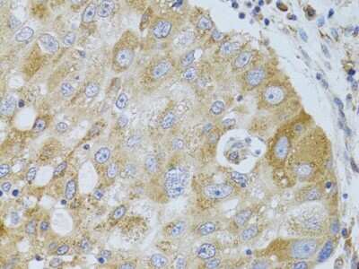 Immunohistochemistry-Paraffin: Histone Deacetylase 8/HDAC8 Antibody - BSA Free [NBP3-03473]