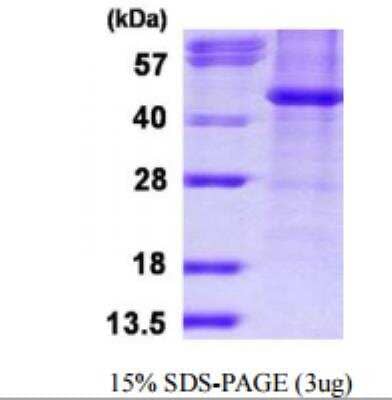 SDS-PAGE: Recombinant Human Histone Deacetylase 8/HDAC8 His Protein [NBP1-78828]