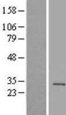 Western Blot: Histone H1.1 Overexpression Lysate [NBL1-11551]