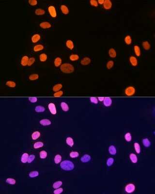 Immunocytochemistry/ Immunofluorescence: Histone H1.2 Antibody (9T9Q7) [NBP3-15291]