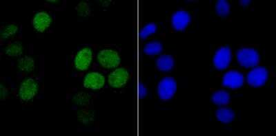 Immunocytochemistry/ Immunofluorescence: Histone H1.2 Antibody (JU43-48) [NBP2-75932]