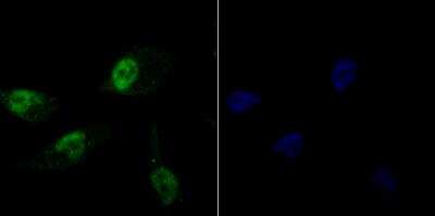 Immunocytochemistry/ Immunofluorescence: Histone H1.2 Antibody (JU43-48) [NBP2-75932]