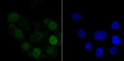 Immunocytochemistry/ Immunofluorescence: Histone H1.2 Antibody (JU43-48) [NBP2-75932]