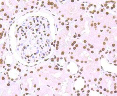 Immunohistochemistry-Paraffin: Histone H1.2 Antibody (JU43-48) [NBP2-75932]
