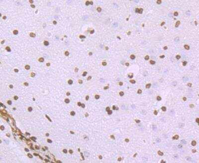 Immunohistochemistry-Paraffin: Histone H1.2 Antibody (JU43-48) [NBP2-75932]