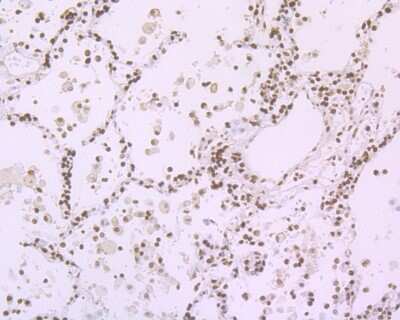 Immunohistochemistry-Paraffin: Histone H1.2 Antibody (JU43-48) [NBP2-75932]