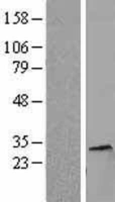 Western Blot: Histone H1.5 Overexpression Lysate [NBL1-11552]