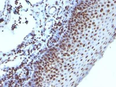 Immunohistochemistry-Paraffin: H1F0 Antibody (1415-1) - Azide and BSA Free [NBP2-47752]