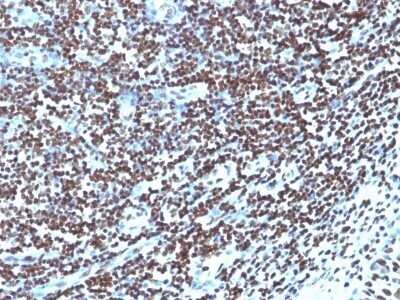 Immunohistochemistry-Paraffin: H1F0 Antibody (1415-1) - IHC-Prediluted [NBP2-48078]