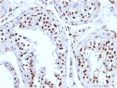 Immunohistochemistry-Paraffin: H1F0 Antibody (1415-1) [NBP2-45181]
