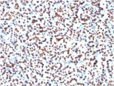 Immunohistochemistry-Paraffin: H1F0 Antibody (1415-1) [NBP2-45181]