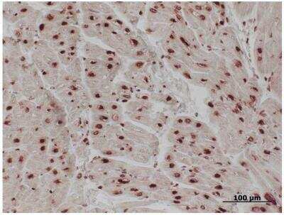 Immunohistochemistry: Histone H1 Antibody (21NC85) [NB100-65220]