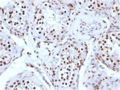 Immunohistochemistry-Paraffin: H1F0 Antibody (AE-4) - IHC-Prediluted [NBP2-48077]