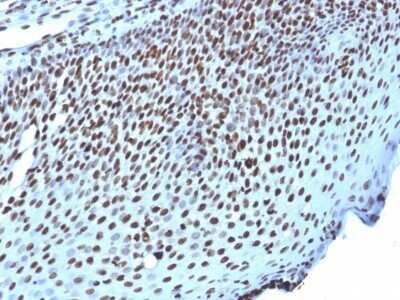 Immunohistochemistry-Paraffin: H1F0 Antibody (AE-4) - IHC-Prediluted [NBP2-48077]