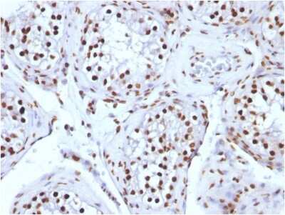 Immunohistochemistry-Paraffin: H1F0 Antibody (AE-4) [NBP2-45182]