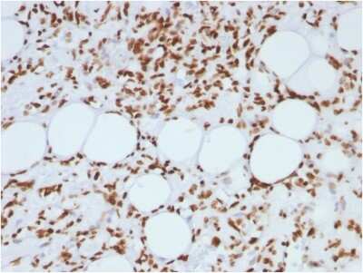Immunohistochemistry-Paraffin: H1F0 Antibody (AE-4) [NBP2-45182]