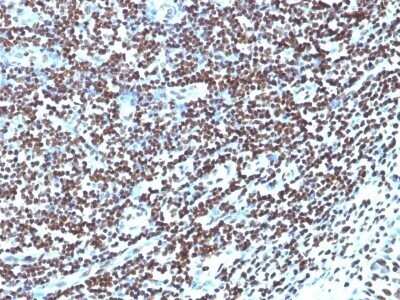 Immunohistochemistry-Paraffin: Histone H1 Antibody (HH1/957) - Azide and BSA Free [NBP2-47754]
