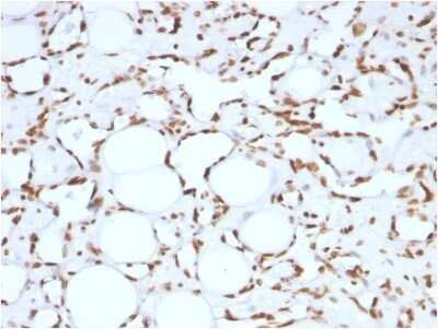 Immunohistochemistry-Paraffin: Histone H1 Antibody (HH1/957) - IHC-Prediluted [NBP2-48087]