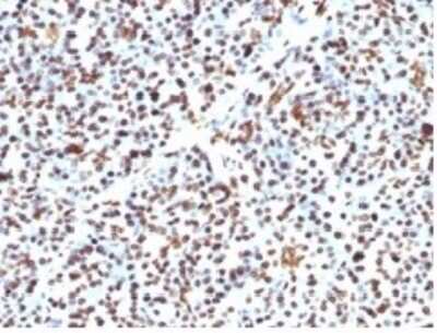 Immunohistochemistry-Paraffin: Histone H1 Antibody (HH1/957) - IHC-Prediluted [NBP2-48087]