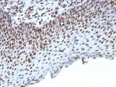 Immunohistochemistry-Paraffin: Histone H1 Antibody (HH1/957) [NBP2-45184]